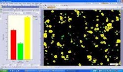 resizedimage268156-Semi_Automatic_Particle_Detection resizedimage268156-Semi_Automatic_Particle_Detection