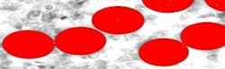 resizedimage29190-Before_Morphological_Filter resizedimage29190-Before_Morphological_Filter