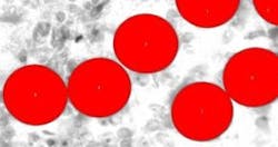 resizedimage290153-After_Morphological_Filter resizedimage290153-After_Morphological_Filter