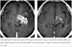 pm0606_upfront_photos pm0606_upfront_photos