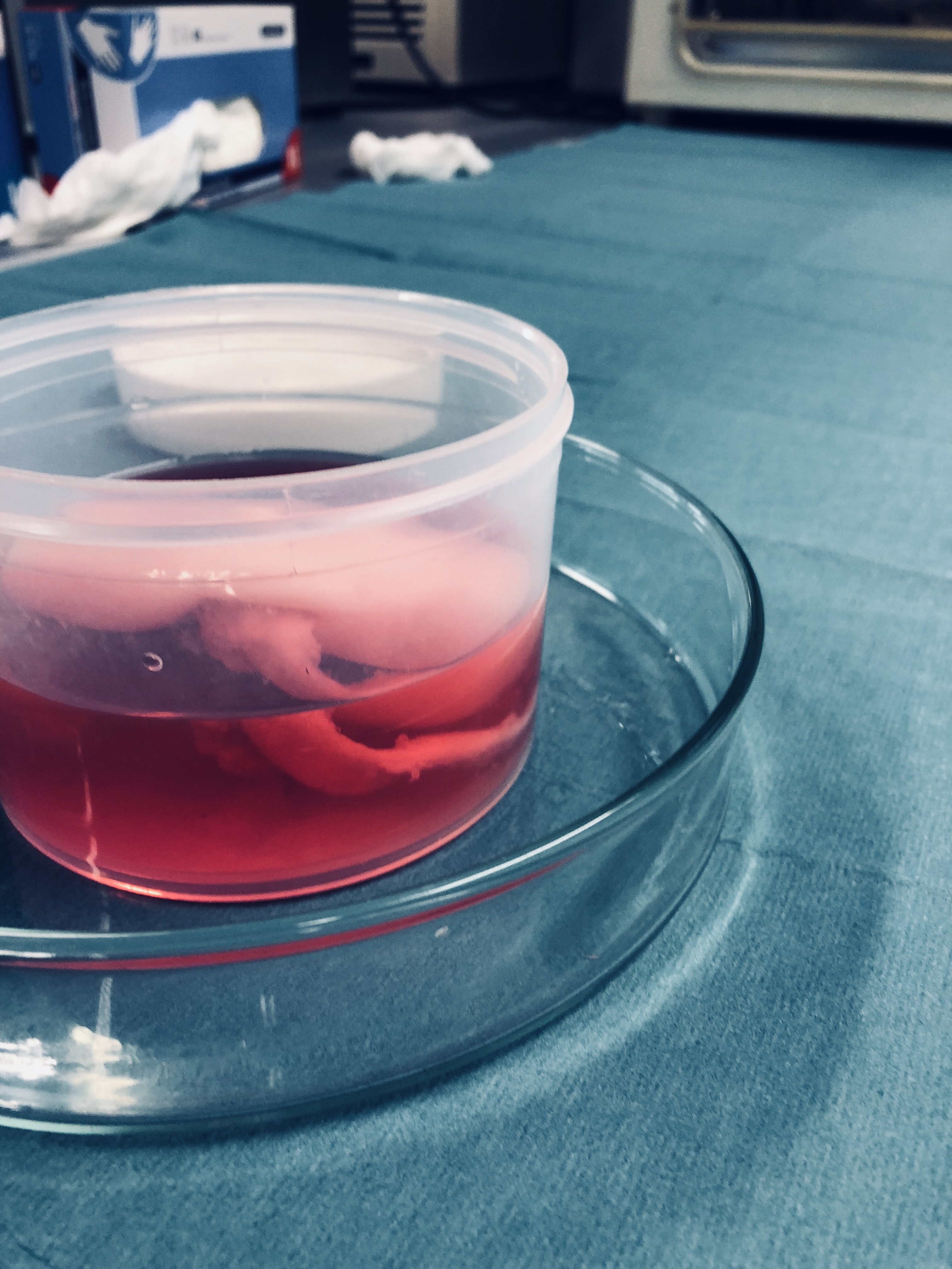 1660318548255 Kidney2