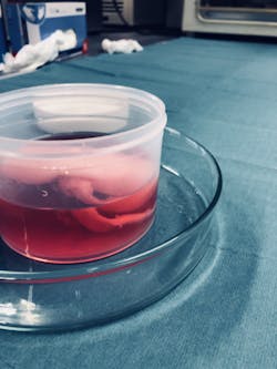 1660318548255 Kidney2 1660318548255 Kidney2