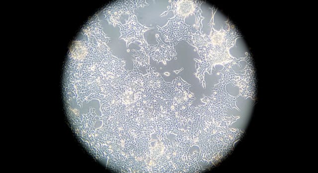 Human embryonic kidney cells