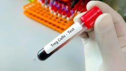 Treg Cells in test tube vial Treg Cells in test tube vial