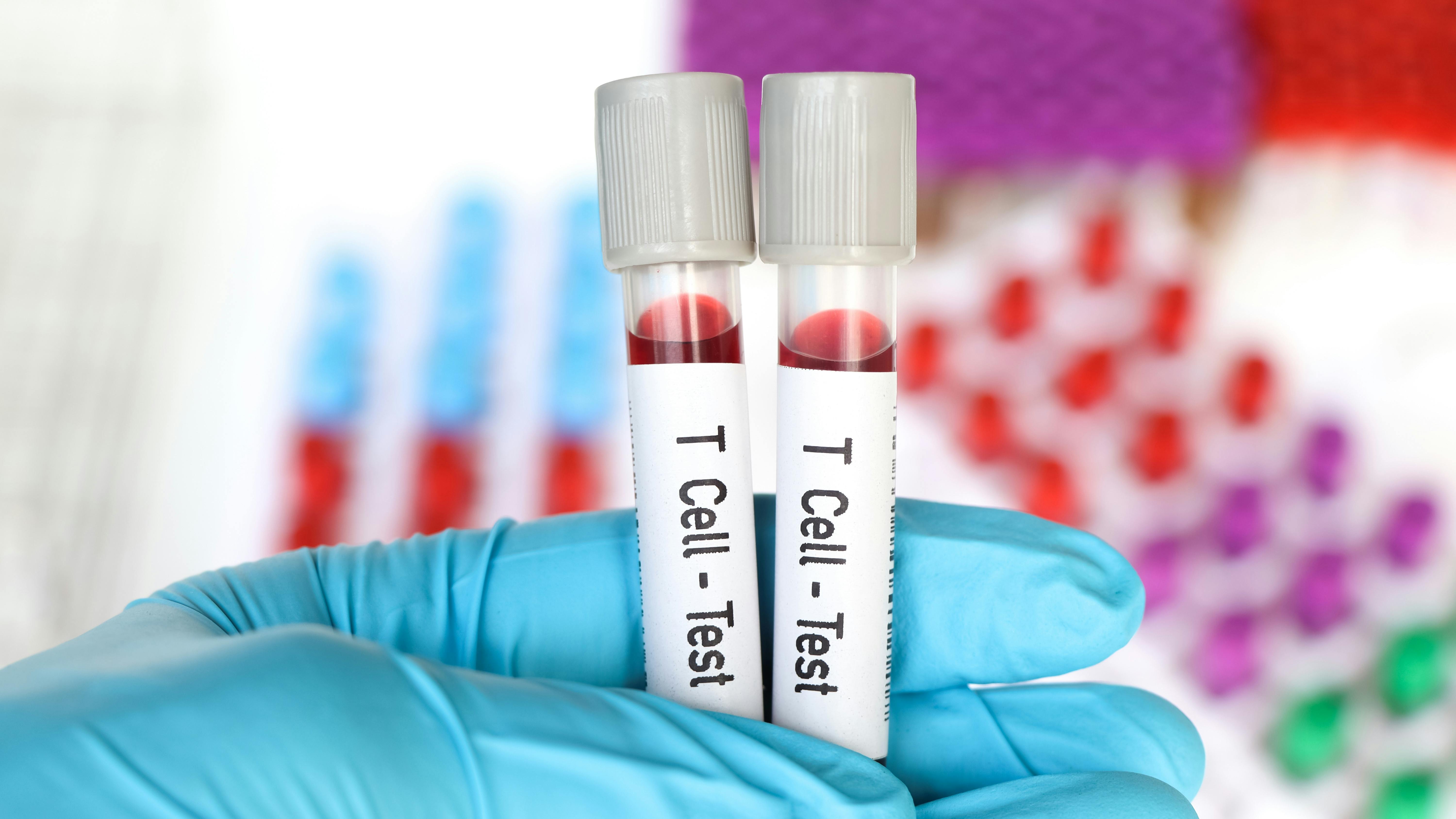 T Cell - Test, blood sample to analyze in the laboratory, blood in test tube