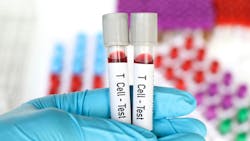 T Cell - Test, blood sample to analyze in the laboratory, blood in test tube T Cell - Test, blood sample to analyze in the laboratory, blood in test tube