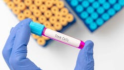 Blood sample tube contain stem cells for cell therapy blood sample in test tube on doctor hand in medical lab Blood sample tube contain stem cells for cell therapy blood sample in test tube on doctor hand in medical lab