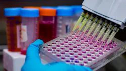 A gloved hand holds a microwell plate being filled with pink liquid using a multi-channel pipette. A gloved hand holds a microwell plate being filled with pink liquid using a multi-channel pipette.