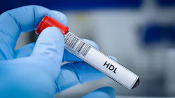 Blood sample tube for high density lipoprotein (HDL) test analysis.